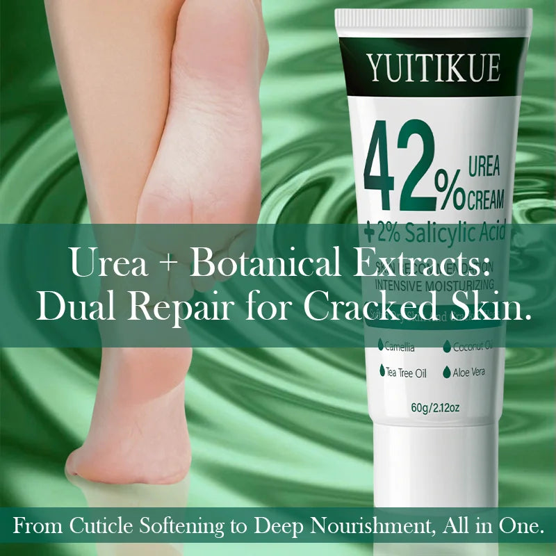 YUITIKUE 42% Urea Cream – Dry Skin & Cuticle Softener 60g