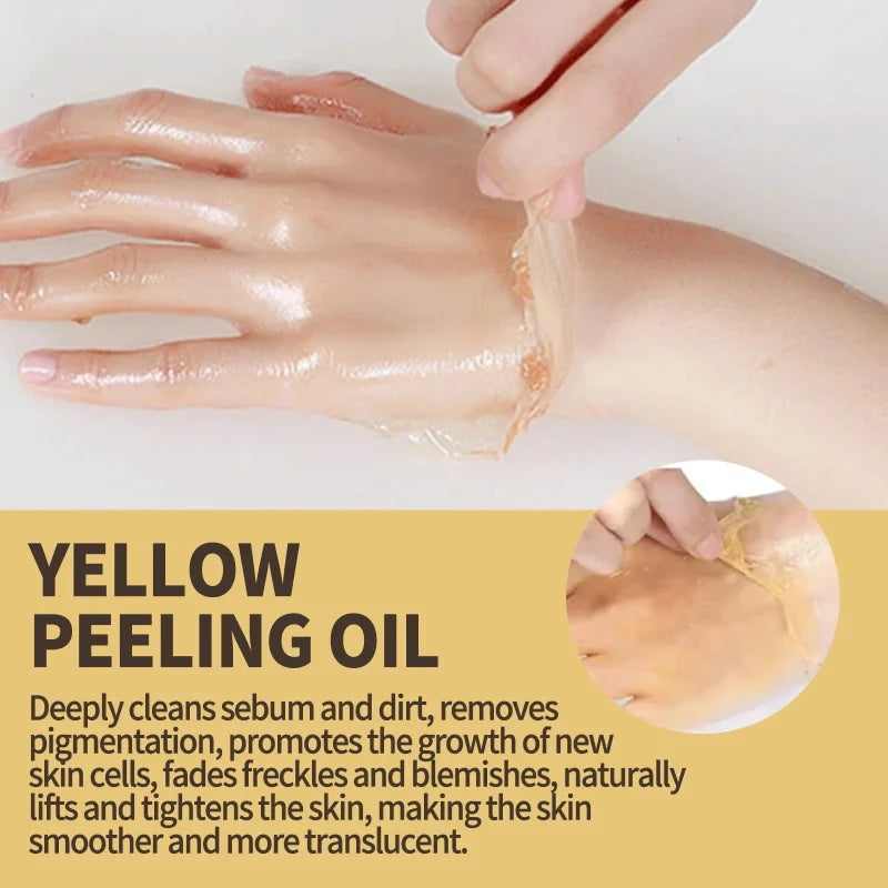 Strong Yellow Peeling Oil Bleach Dark Skin Whiten Lotion Lighten Body Elbow Knee Hand Exfoliate Dead Skin Nourish Even Skin Tone Oasis Select
