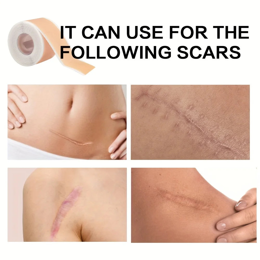 Scars Covering Patch,Invisible Silicone Patch,Skin Care Covering Patch 150cm(59.1in) Oasis Select