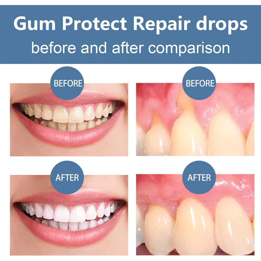 Gum Protect Repair Drops Strengthens Gum Attachment Relieves Oral Discomfort Oral Care For Teeth Brightening Serum Oasis Select