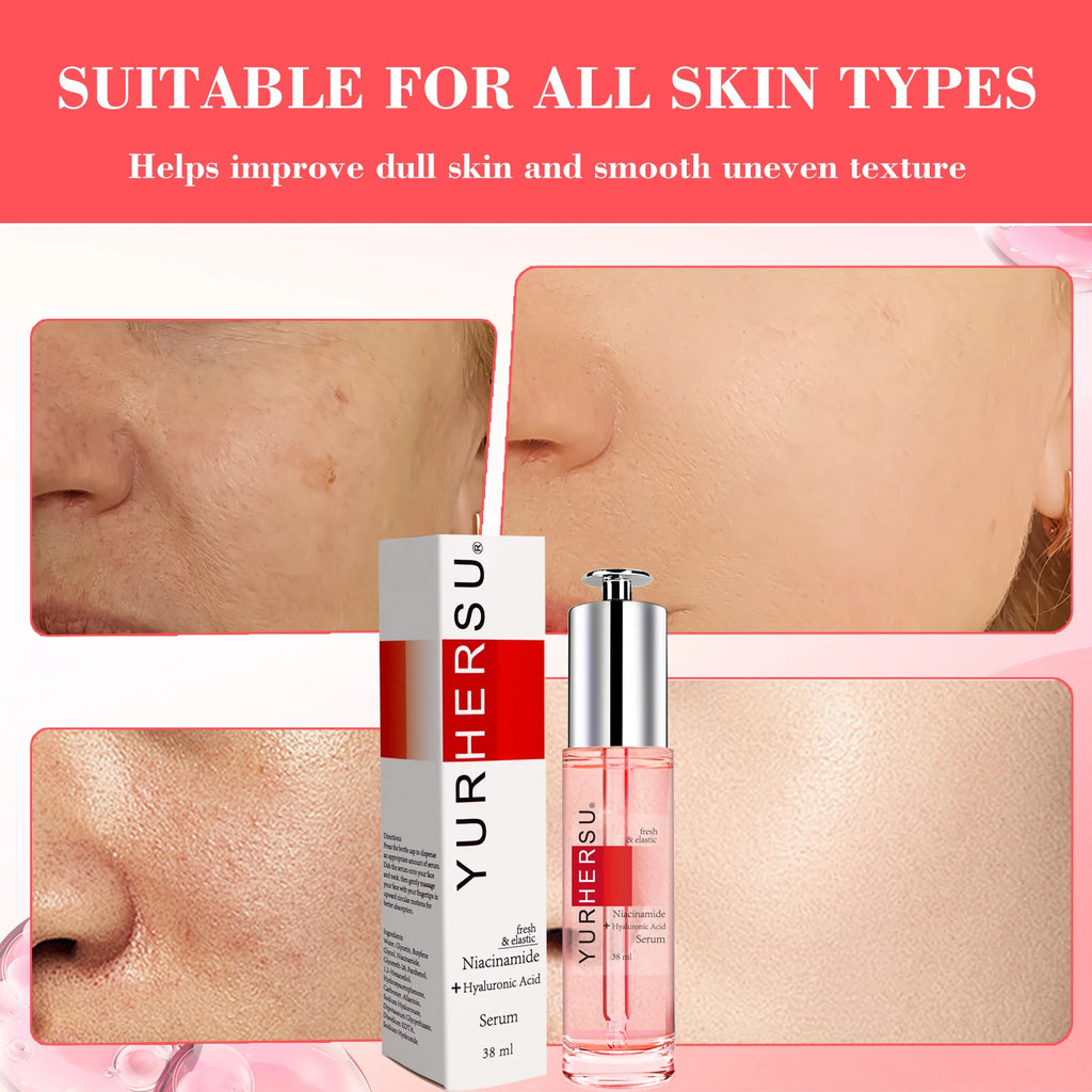 Niacinamide Face Serum – Moisturizing & Translucent Lotion Face Serum Oasis Select Default Title