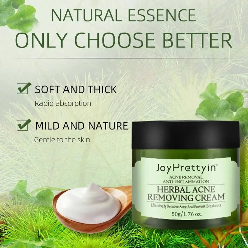 JoyPretty Herbal Acne Face Cream – Oil Control & Marks Removal Herbal Acne Cream Oasis Select
