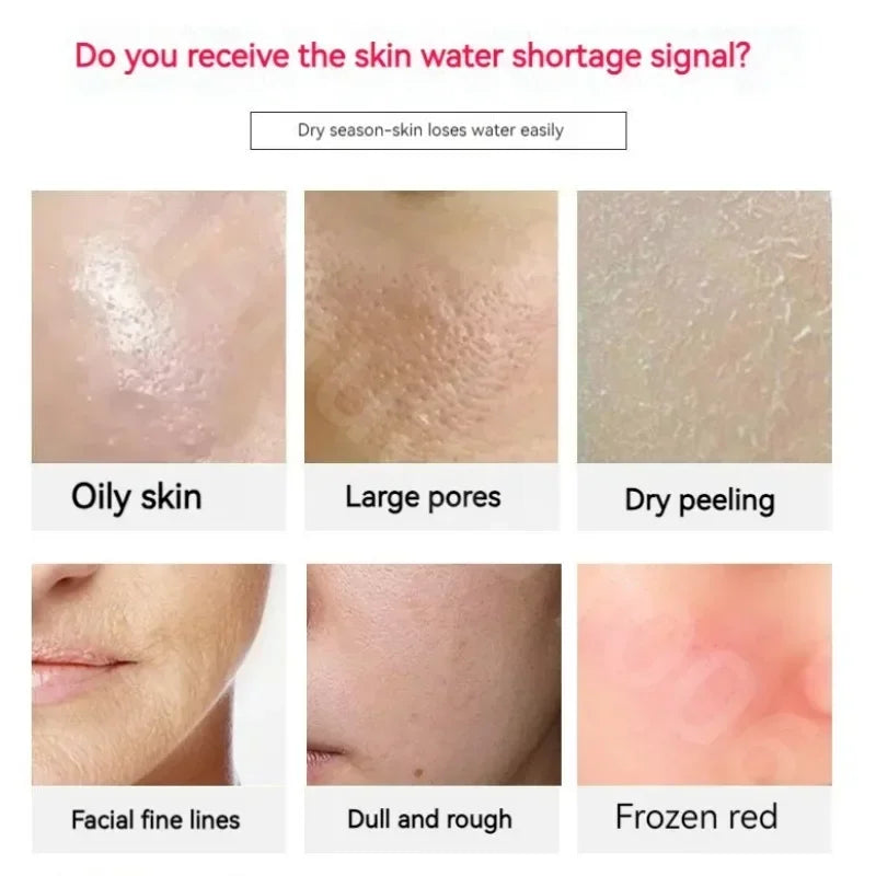 Rose Hydro Boost Water Face Cream with Hyaluronic Acid Dry Skin Whitening for Dark Skin Soothing Hydrating Facial Moistrurizer Oasis Select
