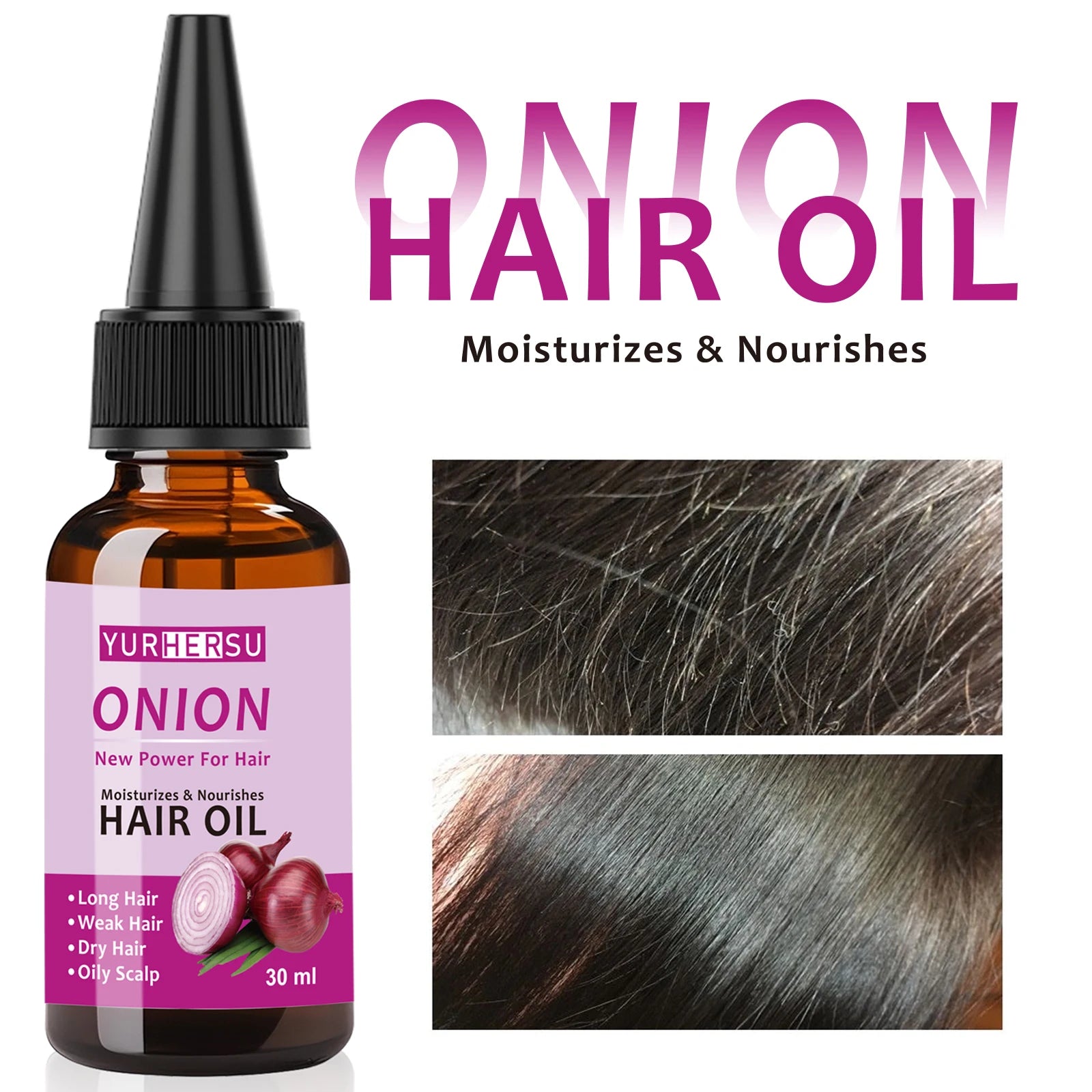 YURHERSU Onion Hair Oil – Pure Natural Hair Growth Treatment Hair Growth Oil Oasis Select