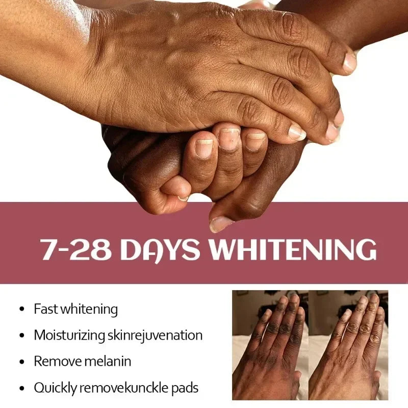 Brightening Hand Cream – Dark Knuckle & Skin Tone Corrector