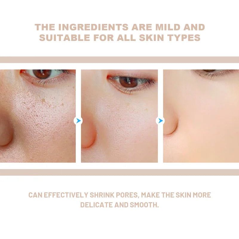 Exfoliating Gel Scrub Remove Dead Skin Deep Clean Face & Body Unclog Pores Gentle Cleansing Exfoliator Daily Skin Care Jelly Oasis Select
