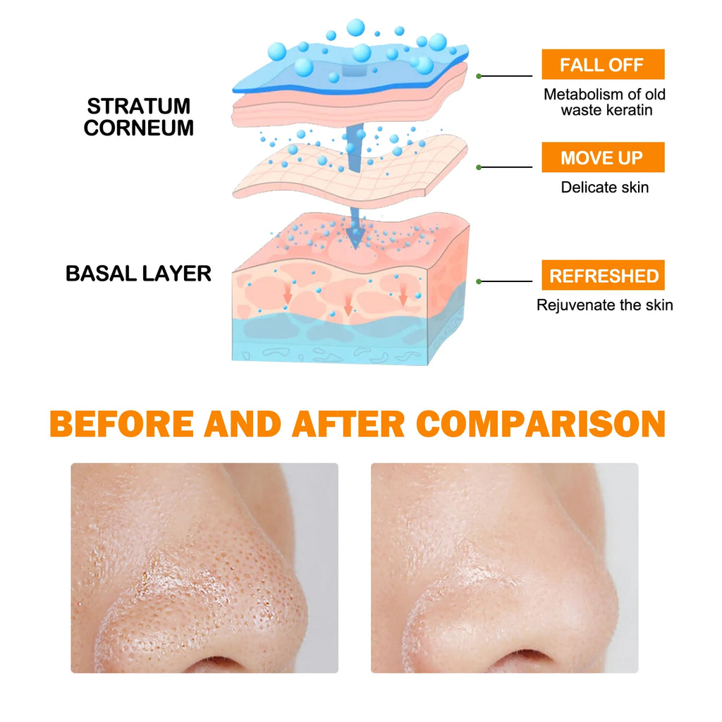 Enzymes Exfoliating Brightening Gel Salicylic Acid Blackhead Dead Skin Remover Cleansing Shrink Pores Brightening Delicate Skin Oasis Select