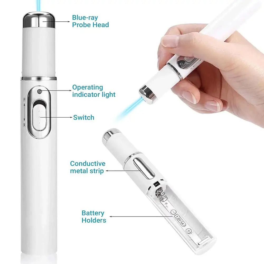 Under-Eye Blue Light Therapy Pen for Face, LED Light Massage Beauty Device with Heat, Vibration, for Dark Circles & Puffiness Oasis Select
