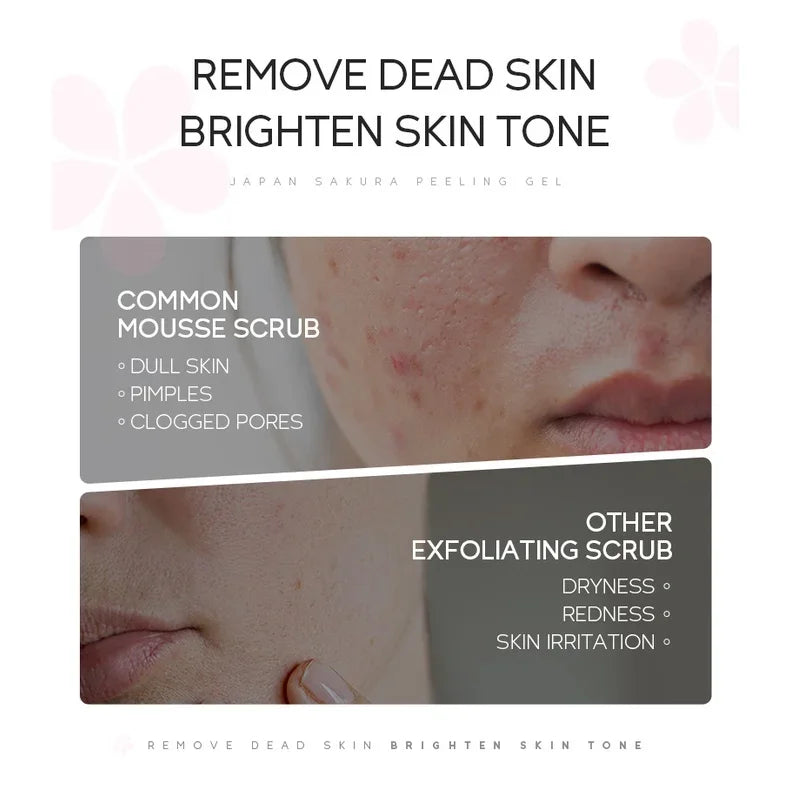 LAIKOU Sakura Peeling Gel Facial Exfoliation Cleans Pores Moisturizing Oil Control 60g Oasis Select