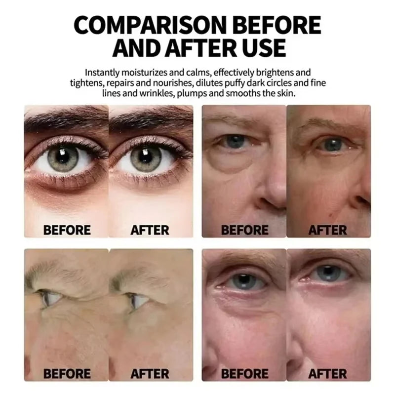 Instant Eye Bag Remove Eye Cream Anti Fat Particles Dark Circles Puffiness Fade Fine Lines Lift Brighten Korean Beauty Eye Care Oasis Select