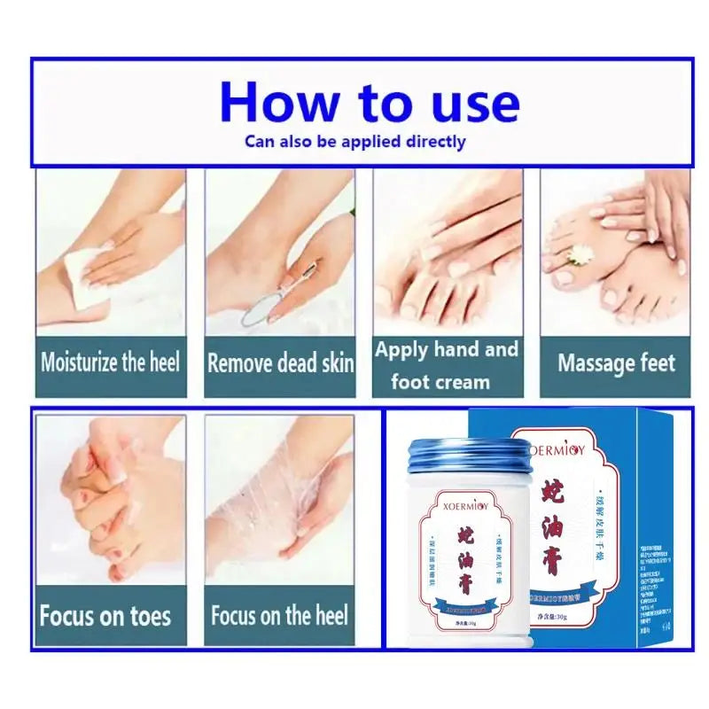 Herbal Anti-Crack Foot Cream – Heel Repair & Moisturizer Herbal Foot Cream Oasis Select