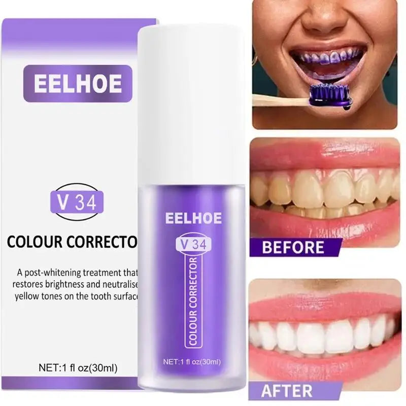 V34 Whitening Toothpaste 2-Pack | Stain Removal & Fresh Breath