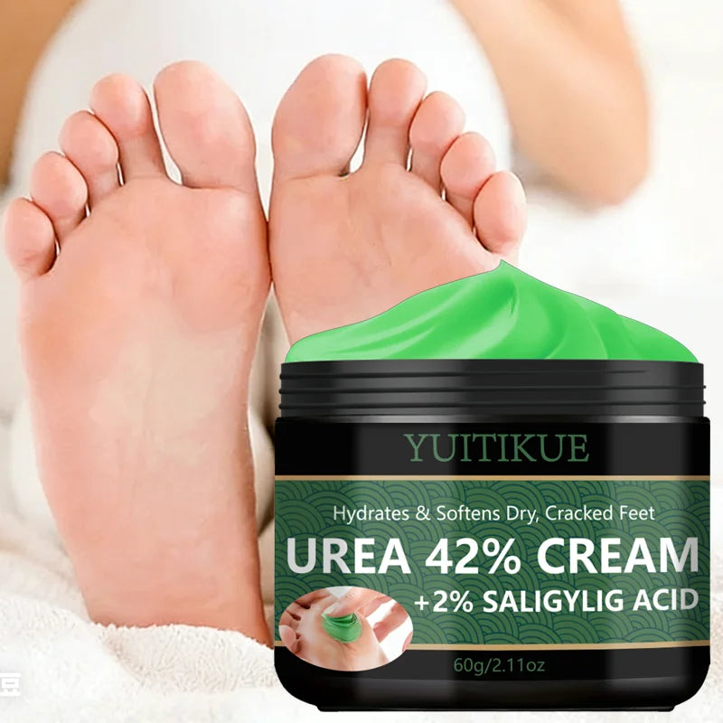 YUITIKUE 42% Urea Foot Cream – Callus & Dry Heel Repair