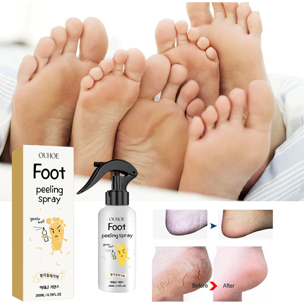Foot Callus Remover Spray Quickly Soften Calluses Exfoliation Dry Feet Skin Hydrating clean Dead repair Skin cuticles Foot Care Oasis Select