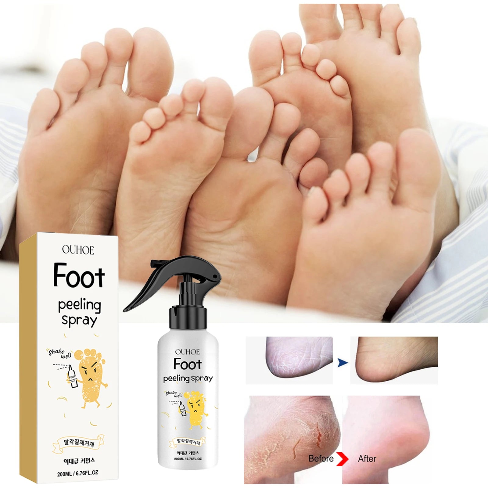 Foot Callus Remover Spray Quickly Soften Calluses Exfoliation Dry Feet Skin Hydrating clean Dead repair Skin cuticles Foot Care Oasis Select
