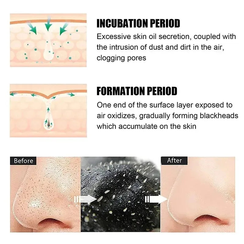 10/150PCS Blackhead Remove Mask Nasal Strips Shrink Cleansing Pore Nose Black Head Remove Stickers Skin Care Mask Patch Unisex Oasis Select