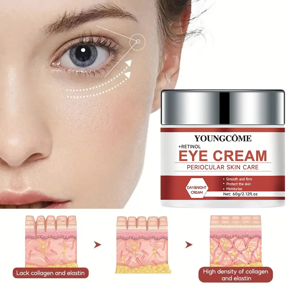 YOUNGCOME Retinol Eye Cream – Firms, Brightens & Moisturizes