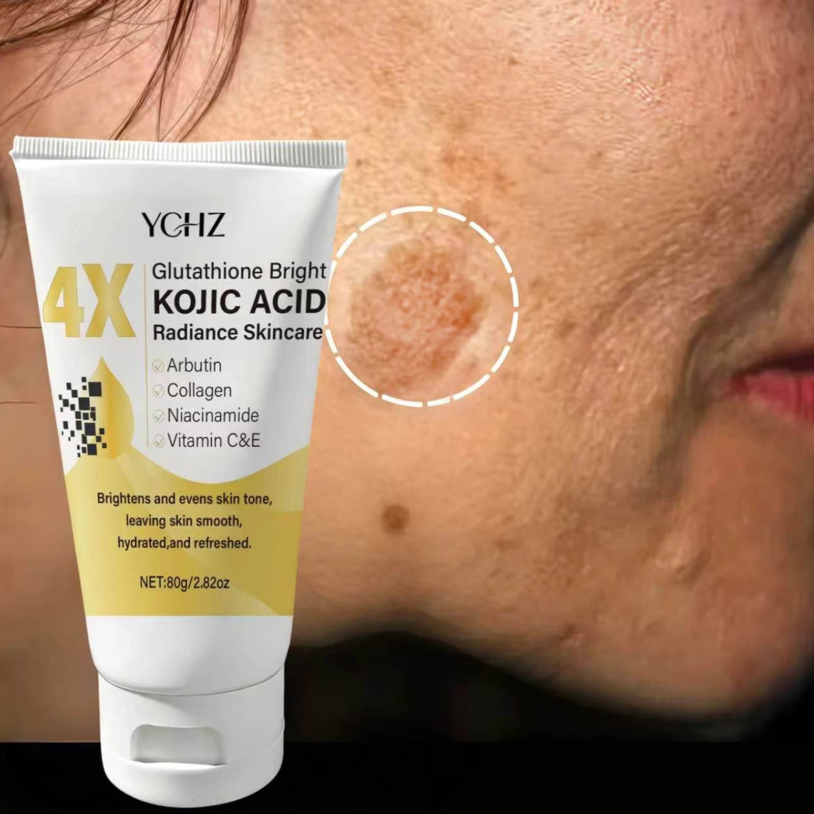 Kojic Acid Face Cream – Brighten Skin & Fade Dark Spots | YCHZ