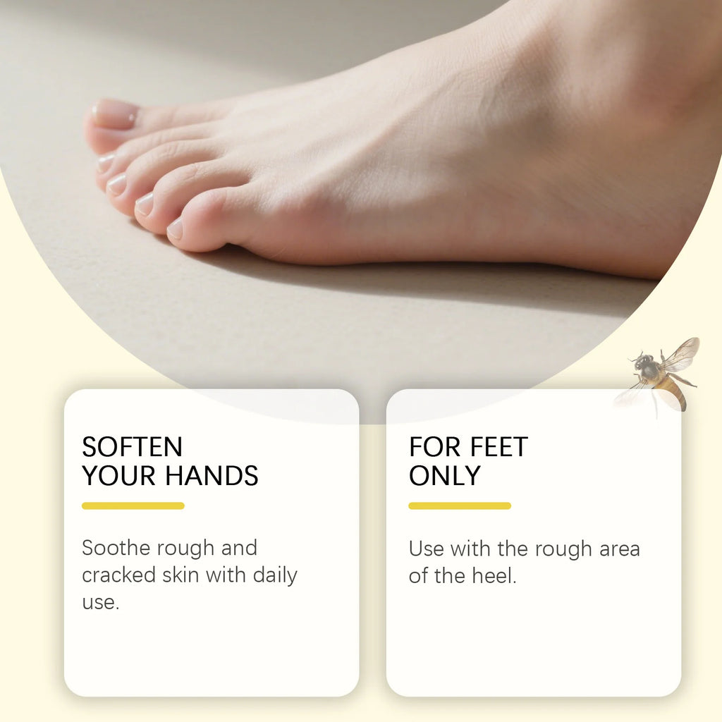 Hoygi 40% Urea Foot & Hand Cream – Deep Moisturizer for Dry Skin Foot & Hand Cream Oasis Select