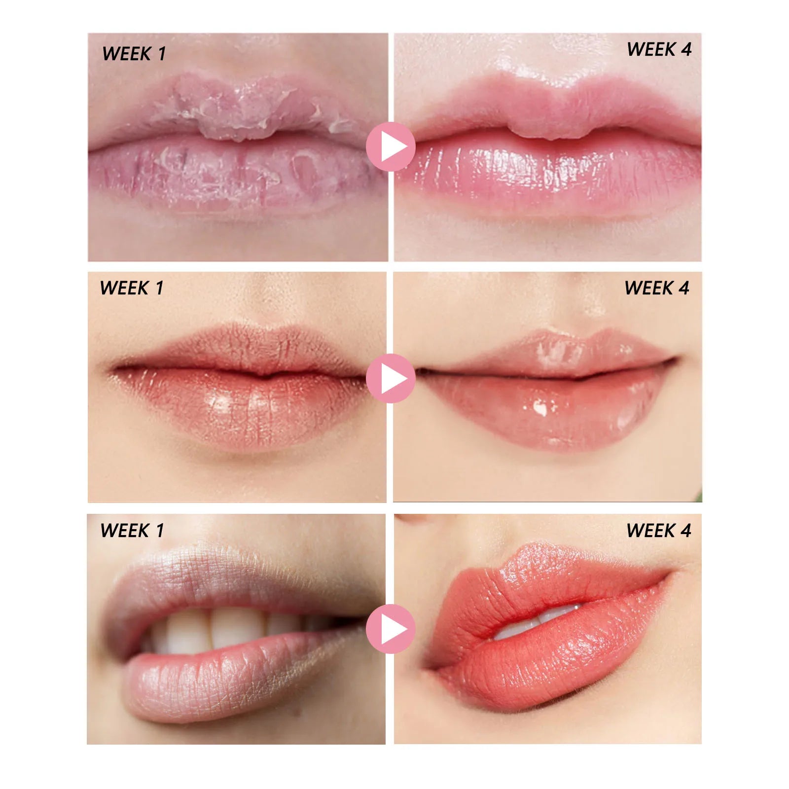Peach Lip Scrub Moisturizing ＆ Moisturizing Lips Preventing Drying ＆ Cracking Diminishing ＆ Improving Dark Skin Around Lips 30g Oasis Select