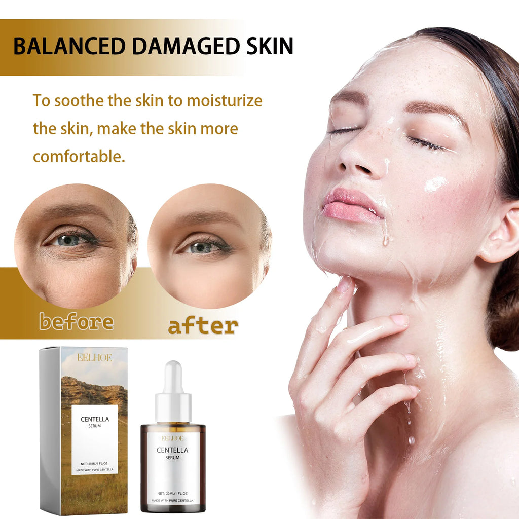 Centella Serum Nourish Improvement Dry Skin Smoothing Tightening Brightening Moisturizing Hyaluronic Acid Face Essence Skin Care Oasis Select