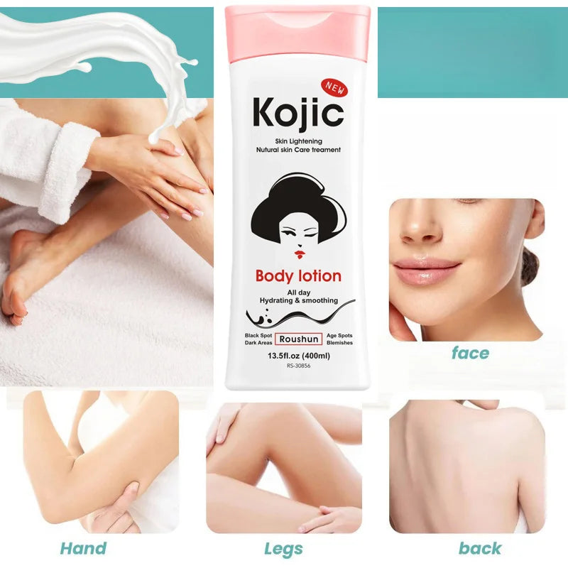 ROUSHUN 400ml Kojic Acid Body Lotion – Moisturizing & Brightening