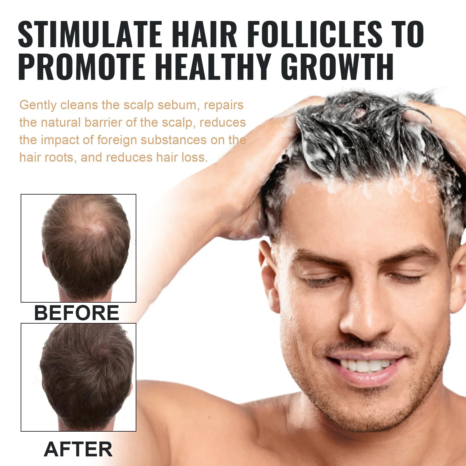 EELHOE Hair Loss Shampoo – Growth, Thickening & Scalp Repair Hair Growth Shampoo Oasis Select