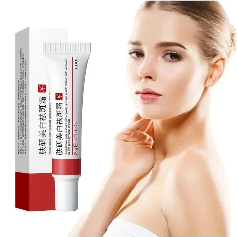 1/3/5pcs Whitening Freckle Cream Niacinamide Remove Dark Spot Cream Anti Freckle and Aging Cream Fade Pigmentation Melasma Skin Oasis Select