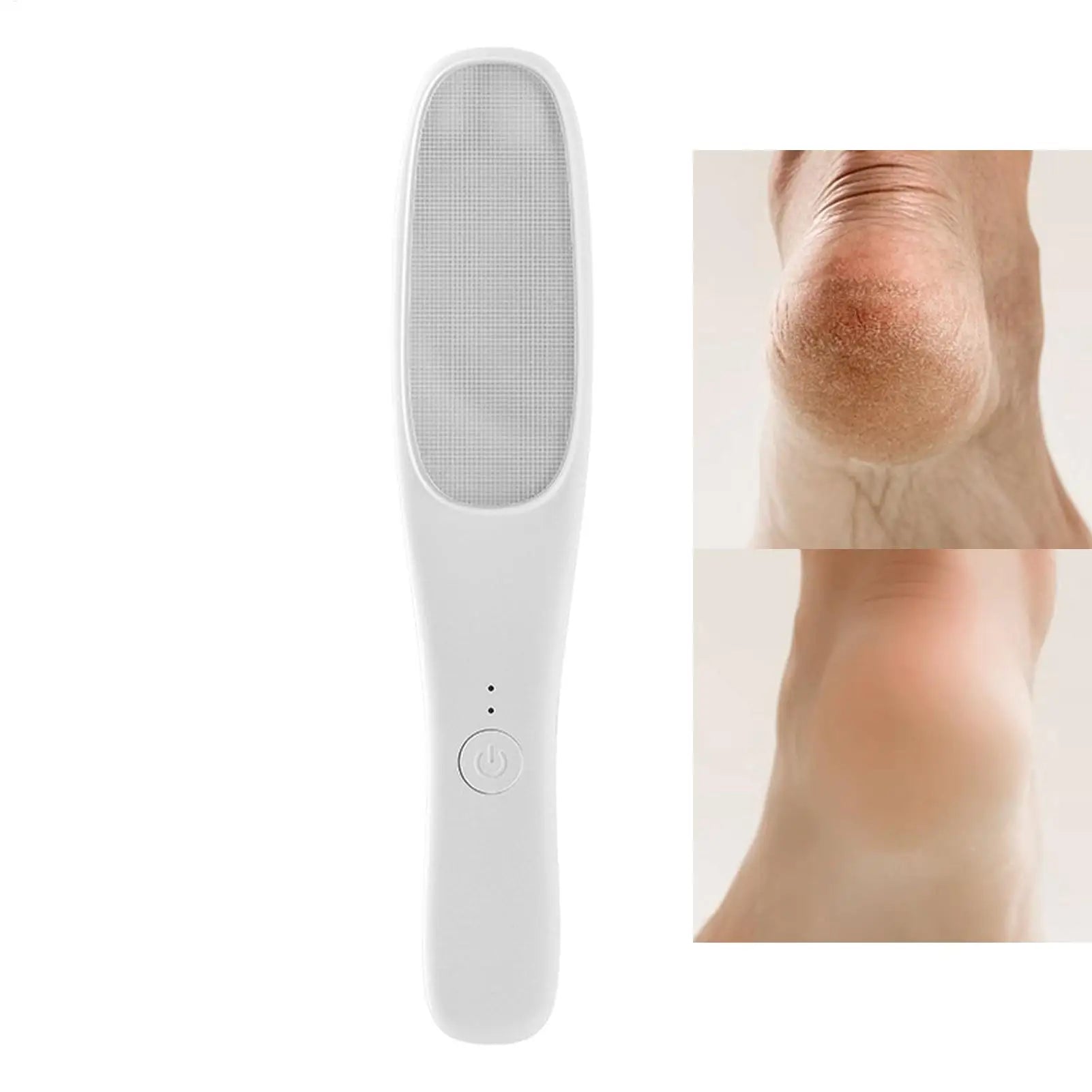 Electric Foot Callus Remover Feet Callus Remove Rechargeable Dead Wet Dry Skin Calluses Foot Cleaner Smooth Electric Foot File Oasis Select