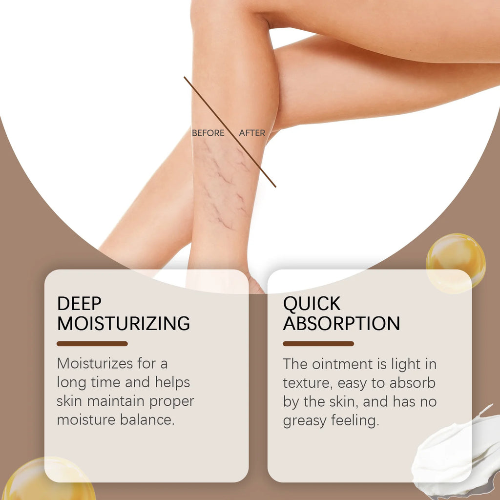 Varicose & Spider Vein Relief Cream – Natural Herbal Ointment Vein Relief Cream Oasis Select