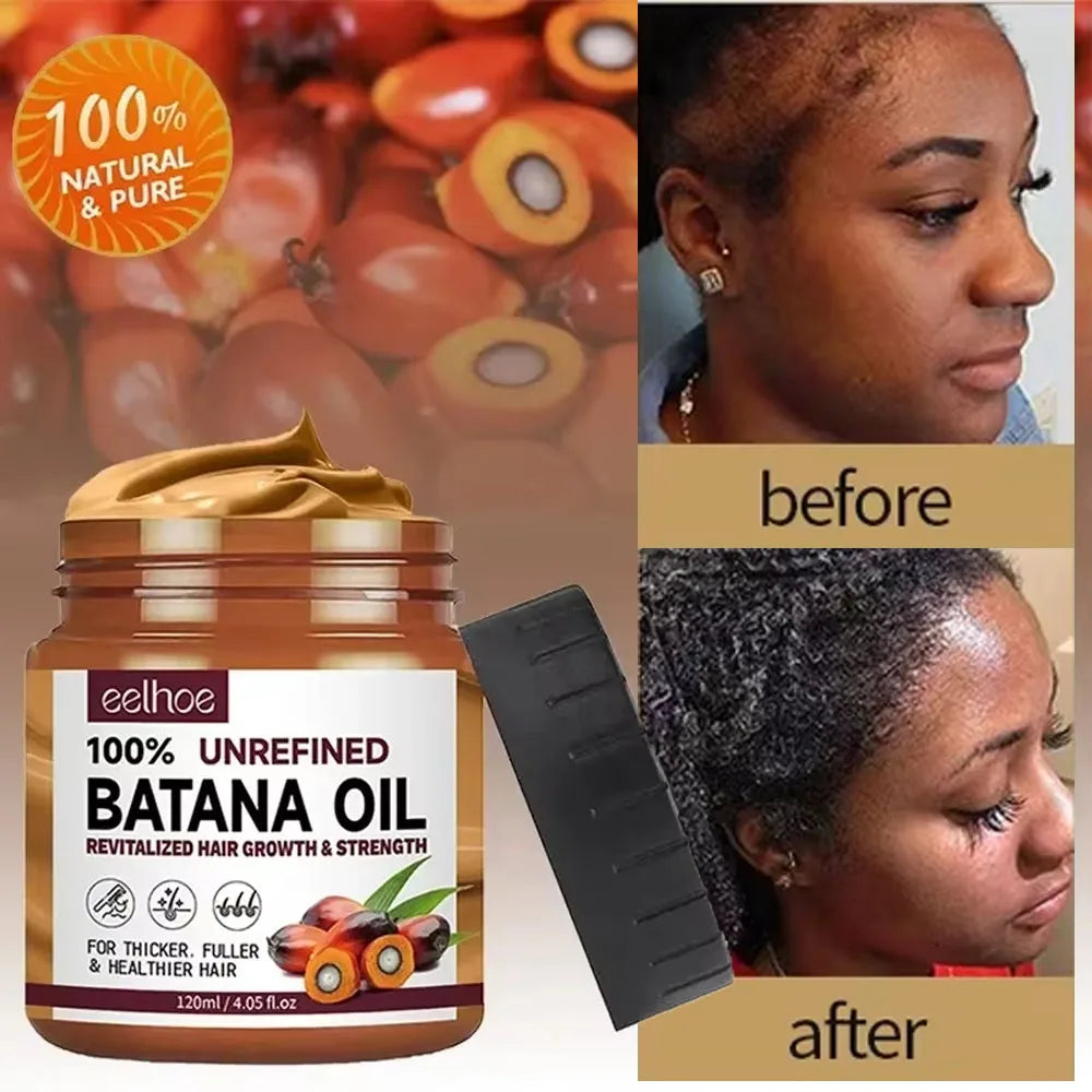 Batana Hair Growth Oil Conditioner Anti Hair Loss Products Fast Growing Hair Mask Nourishing Repair Roots Hair Care for women Oasis Select