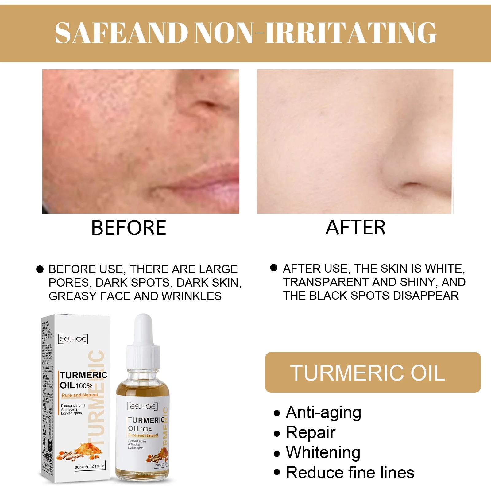 Eelhoe Turmeric Serum – Fades Dark Spots & Brightens Skin