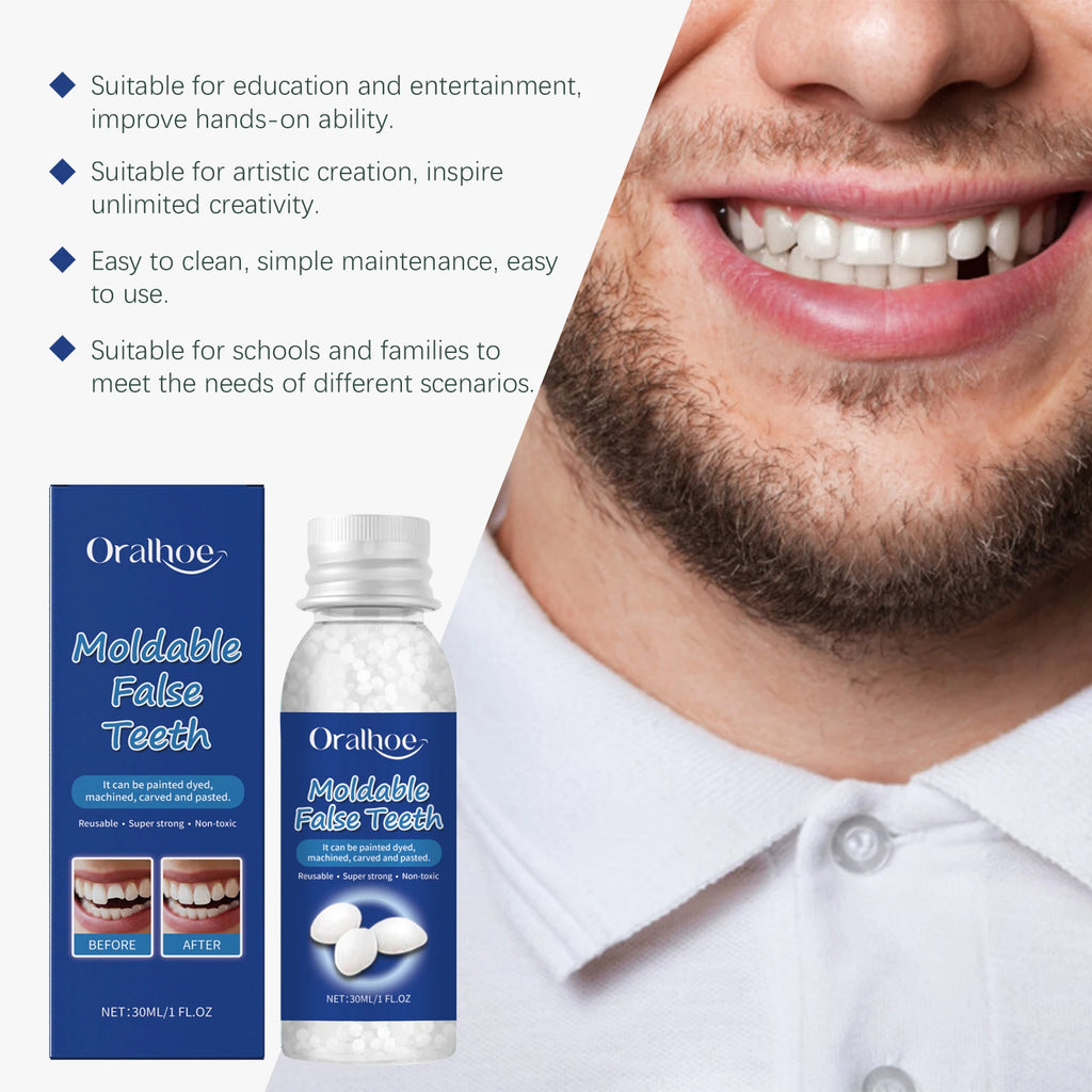 Oralhoe Temporary Tooth Repair Kit – Moldable Resin Dental Glue Temporary Tooth Repair Oasis Select