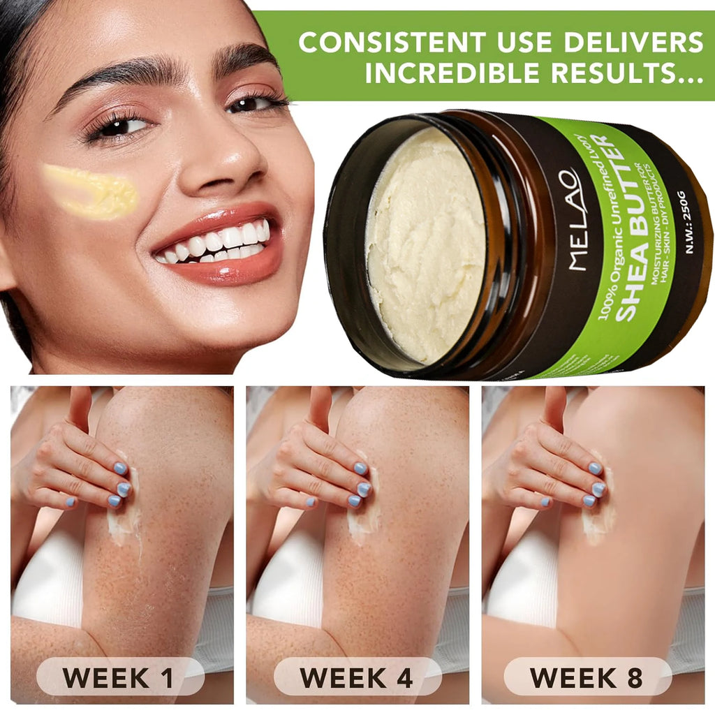 Organic Shea Butter Body Moisturizer 250g – Deep Hydration