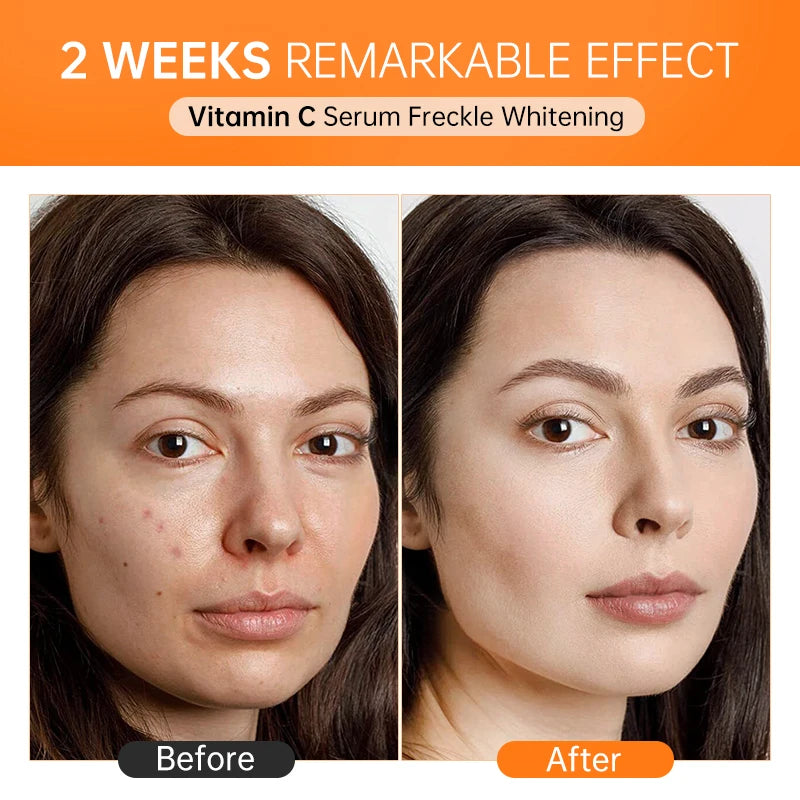 Vitamin C Face Whitening Serum Deep Moisturizing Removal Dark Spots Hyaluronic Acid Essence Anti Aging Facial Serum Skin Care Oasis Select