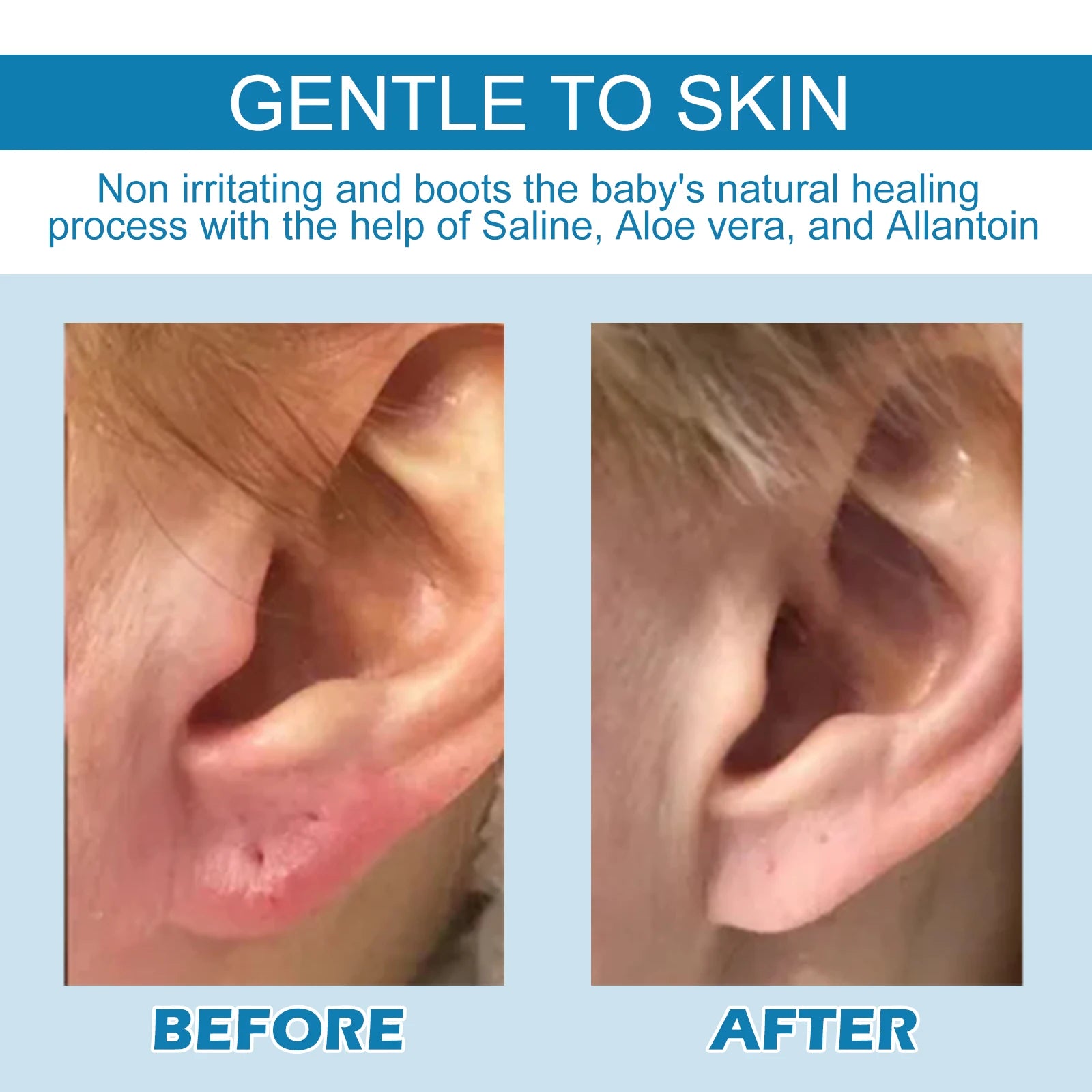 Eelhoe 30ml Ear Piercing Aftercare Solution – Allergy Safe