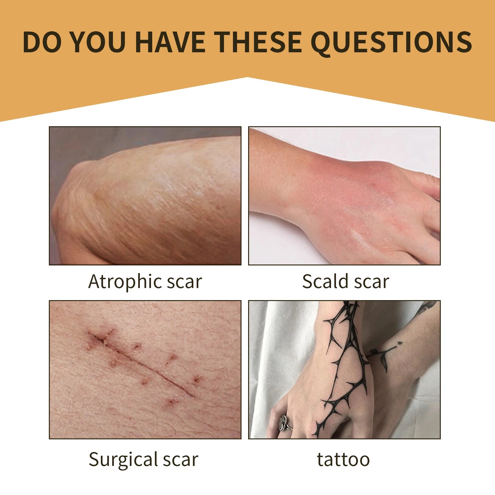 Jaysuing Scar & Tattoo Cover Patches – Waterproof Concealer Body Concealer Patch Oasis Select