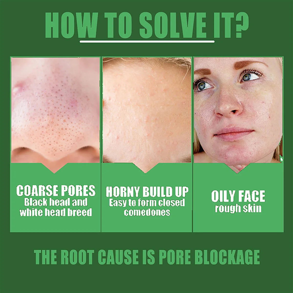 Shrink pores Remove acne marks Essential Oils Desalinate Stain Remove Pouch Licorice Facial Essence Reduces Wrinkles Acne Oasis Select