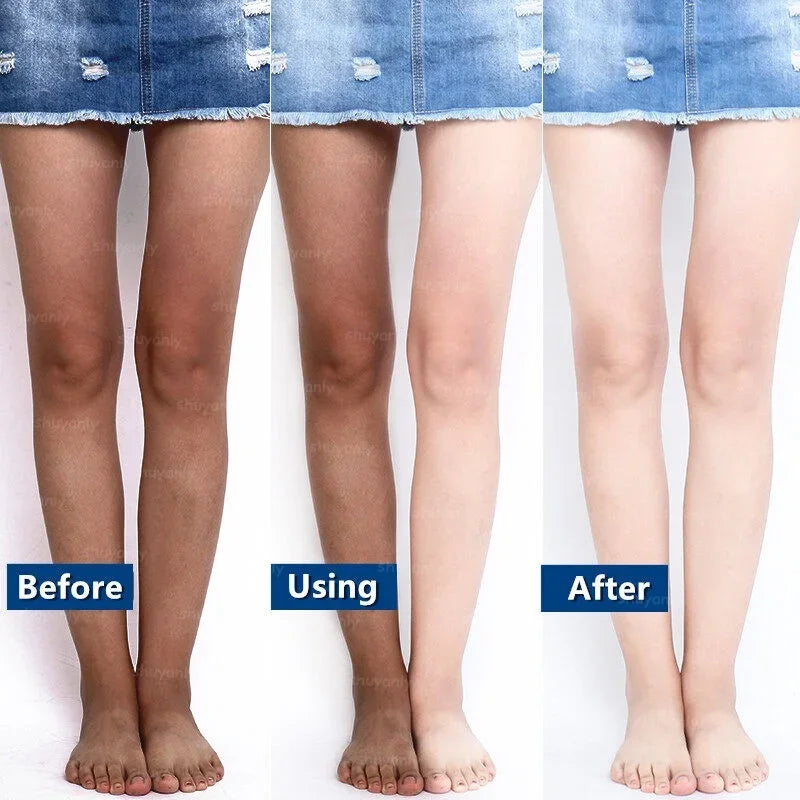 Whitening Cream Fast Whitening Tanning Repair Whole Body Facial Whitening Moisturizing Skin Cleansing Bleaching Remove Darkness Oasis Select