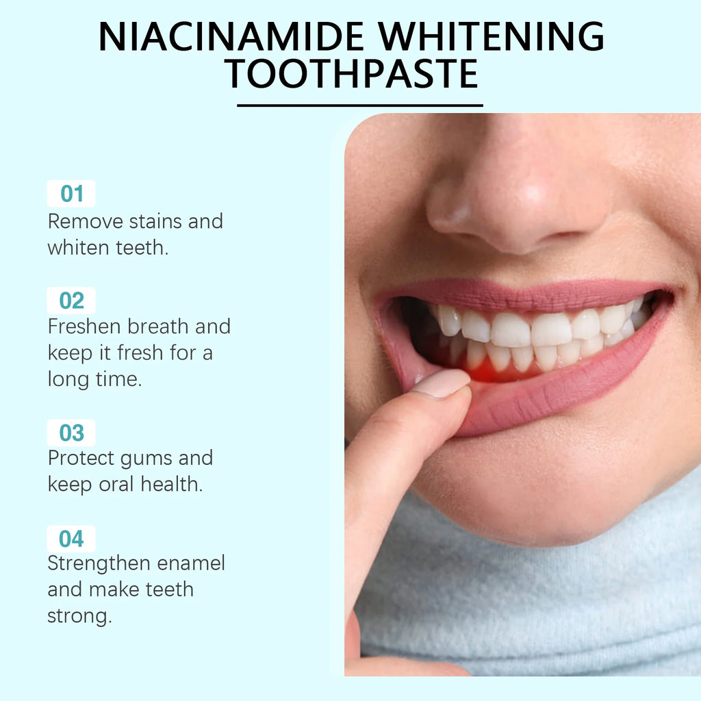 Niacinamide Whitening Toothpaste Dental Stains Removing Prevent Bad Breath Oral Cleaning Refreshing Reduces Plaque Toothpaste Oasis Select