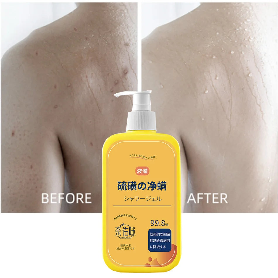 400ml Sulfur Shower Gel – Oil Control & Pore Cleansing Wash