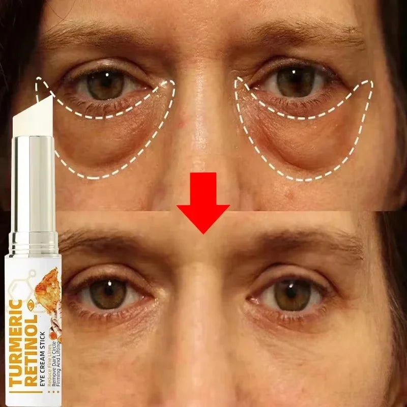 SADOER Retinol Eye Cream – Brighten, Firm & Hydrate Eye Cream Oasis Select