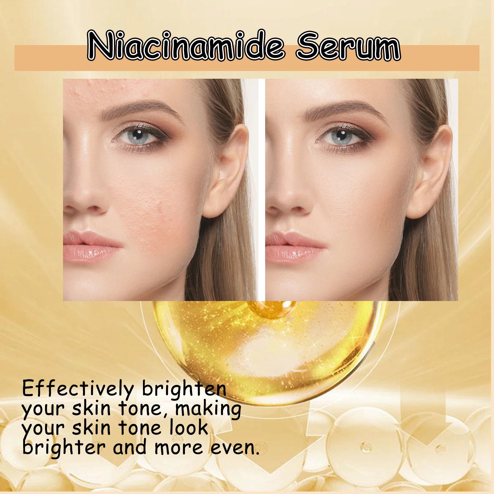 Niacinamide Serum Brightening Face Moisturizing Hydrating Glowing Skin Oil Control Dark Spots Melanin Correcting Facial Serum Oasis Select