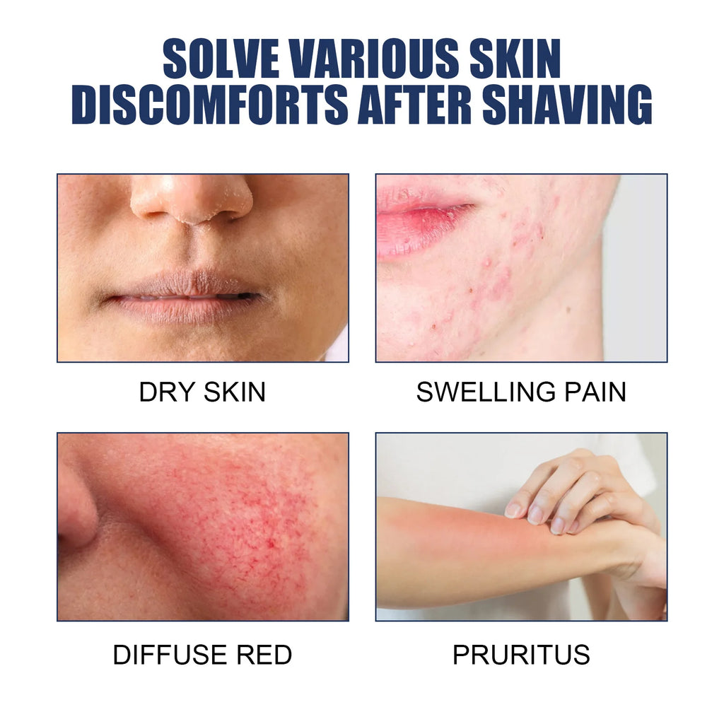 After Shave Repair Lotions Prevent Ingrowns Hair Treatment Smooth Body Skin Reduce Dark Spots Redness Serum for Vanish Pimple Oasis Select
