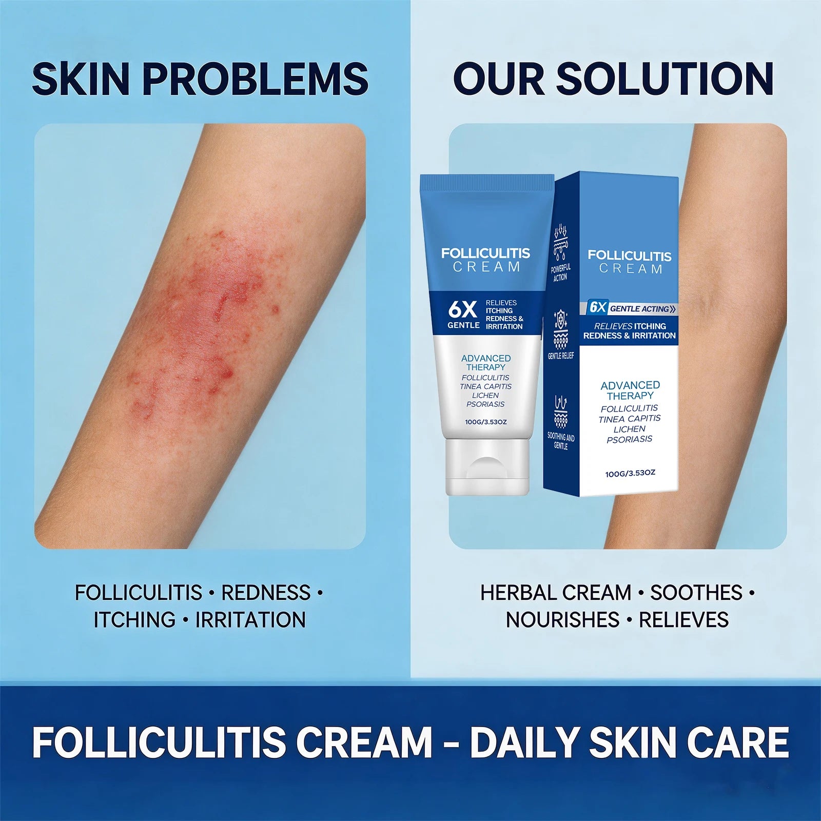 Folliculitis Cream Reduce Redness Relieve Itching Soothing Stimulating Herbal Gentle Smoothing Nourishing Care Cream Oasis Select