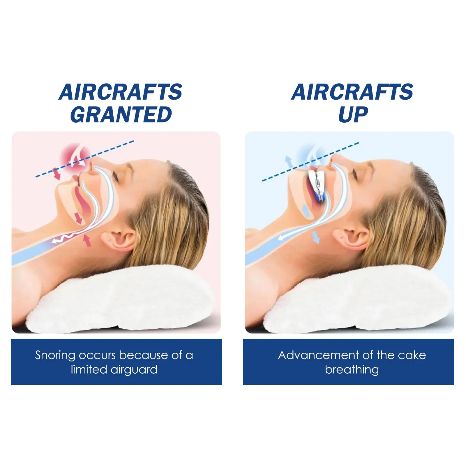Anti-Snoring Mouth Guard – Custom-Fit Night Guard & Teeth Protector