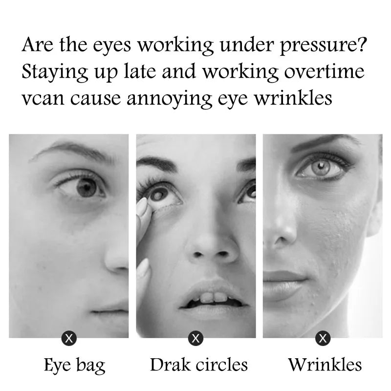 BIOAQUA Golden Caviar Eye Mask – 10 Pairs Hydrating Patches Under Eye Patches Oasis Select