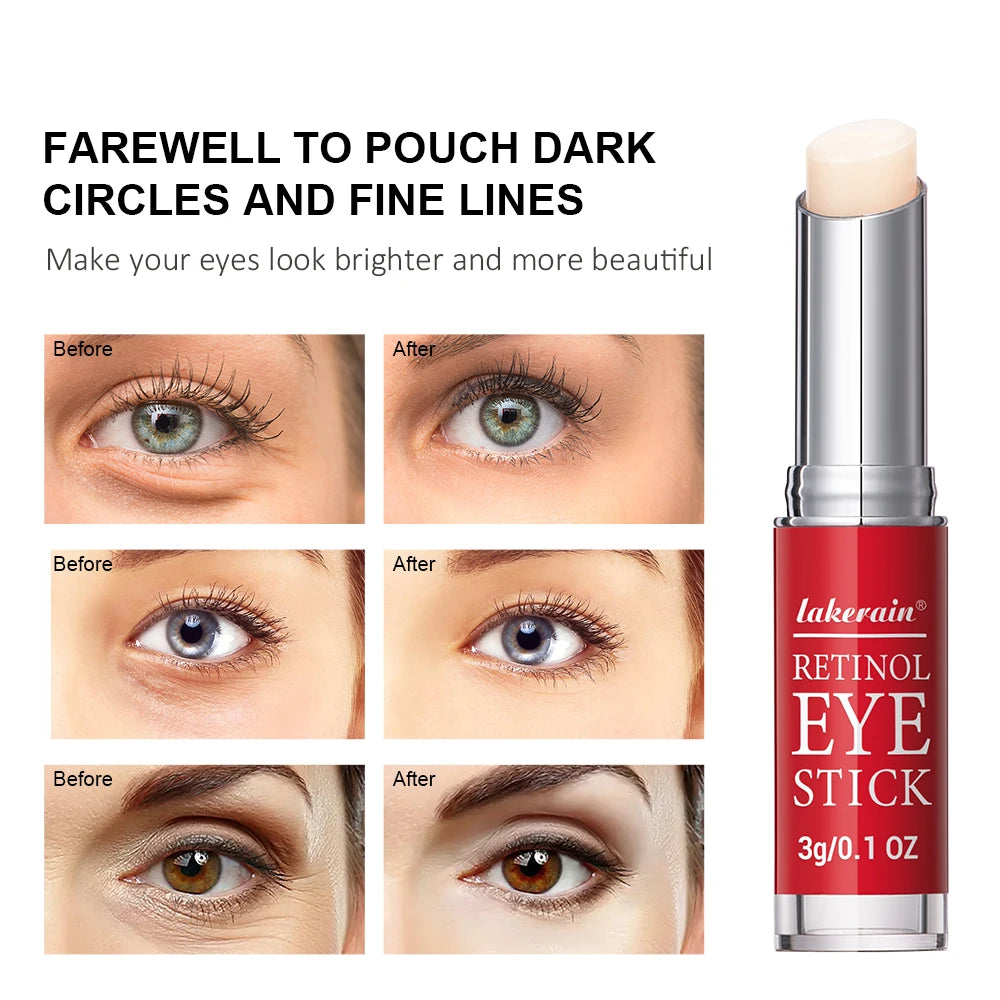 Retinol Eye Cream Stick – Brightening, Firming & Anti-Aging