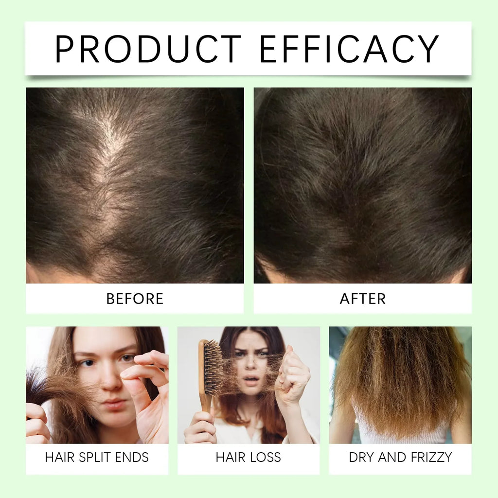 Natural Rosemary Hydrolyzed Keratin Shampoo Deep Nourish Scalp Care Strengthen Damaged Hair Oil Control For Men Women 100ML Oasis Select