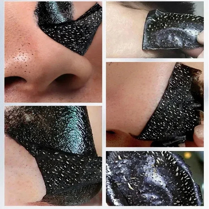 LANBENA Blackhead Remover Peel Mask – Deep Pore Cleansing Blackhead Peel Mask Oasis Select
